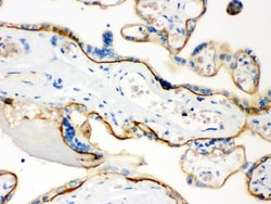 Invitrogen CD55 Polyclonal Antibody 100 &mu;g | Buy Online | Invitrogen&trade; | Fisher Scientific