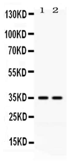 CD58 Polyclonal Antibody:Antibodies, Polyclonal