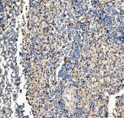 Invitrogen CD63 Polyclonal Antibody 100 &mu;g; Unconjugated:Antibodies,