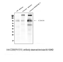 Invitrogen CD68 Polyclonal Antibody 100 &mu;g; Unconjugated:Antibodies,