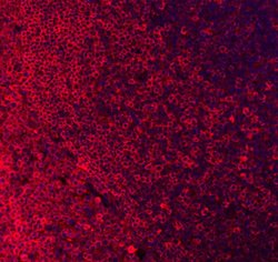 Invitrogen CD79a Polyclonal Antibody 100 &mu;g; Unconjugated:Antibodies,