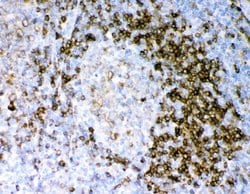 Invitrogen CD79a Polyclonal Antibody 100 &mu;g; Unconjugated:Antibodies,