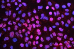 Invitrogen CD79b Polyclonal Antibody 100 &mu;g; Unconjugated:Antibodies,