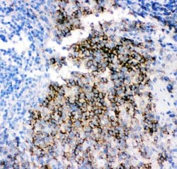 Invitrogen CD79b Polyclonal Antibody 100 &mu;g; Unconjugated:Antibodies,