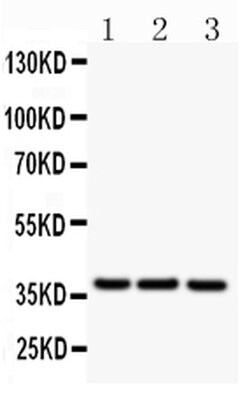 Invitrogen CD79b Polyclonal Antibody 100 &mu;g; Unconjugated:Antibodies,