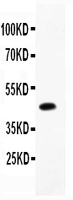 Invitrogen CD79b Polyclonal Antibody 100 &mu;g; Unconjugated:Antibodies,