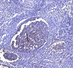 Invitrogen CD81 Polyclonal Antibody 100 &mu;g; Unconjugated:Antibodies,
