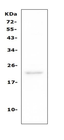 Invitrogen CD81 Polyclonal Antibody 100 &mu;g; Unconjugated:Antibodies,