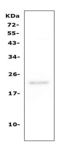 Invitrogen CD81 Polyclonal Antibody 100 &mu;g; Unconjugated:Antibodies,