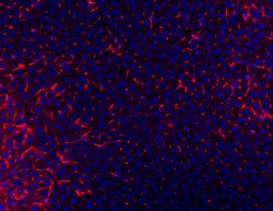 Invitrogen CD81 Polyclonal Antibody 100 &mu;g; Unconjugated:Antibodies,