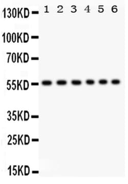Invitrogen CD8 alpha Polyclonal Antibody 100 &mu;g; Unconjugated:Antibodies,