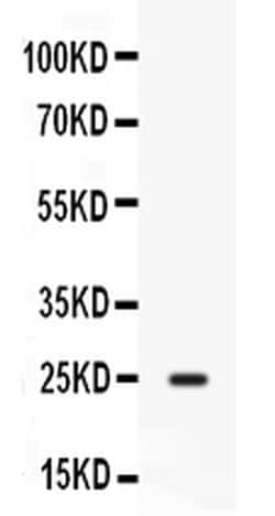 Invitrogen CD9 Polyclonal Antibody 100 &mu;g; Unconjugated:Antibodies,