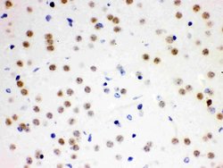 Invitrogen CDC25B Polyclonal Antibody 100 &mu;g; Unconjugated:Antibodies,