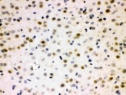 Invitrogen CDC25B Polyclonal Antibody 100 &mu;g; Unconjugated:Antibodies,