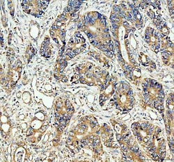 Invitrogen CDC25B Polyclonal Antibody 100 &mu;g; Unconjugated:Antibodies,