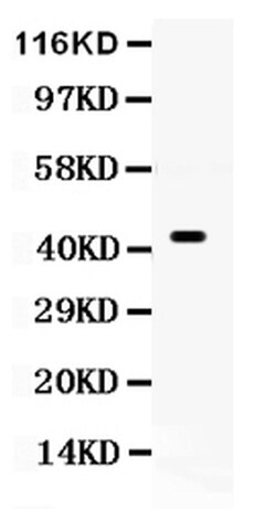 Invitrogen CDC37 Polyclonal Antibody 100 &mu;g; Unconjugated:Antibodies,