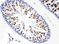 Invitrogen CDC6 Polyclonal Antibody 100 &mu;g; Unconjugated:Antibodies,