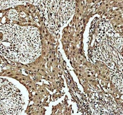 Invitrogen CDK2 Polyclonal Antibody 100 &mu;g; Unconjugated:Antibodies,
