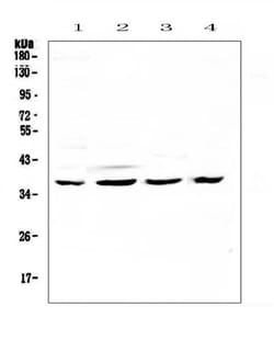 Invitrogen CDK6 Polyclonal Antibody 100 &mu;g | Buy Online | Invitrogen&trade; | Fisher Scientific