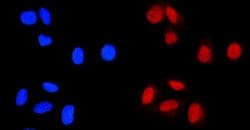 Invitrogen C/EBP beta Polyclonal Antibody 100 &mu;g; Unconjugated:Antibodies,
