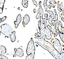 Invitrogen C/EBP beta Polyclonal Antibody 100 &mu;g; Unconjugated:Antibodies,