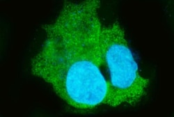 Invitrogen CES1 Polyclonal Antibody 100 &mu;g | Buy Online | Invitrogen&trade; | Fisher Scientific