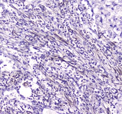 Invitrogen CES1 Polyclonal Antibody 100 &mu;g | Buy Online | Invitrogen&trade; | Fisher Scientific