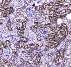 Invitrogen CES1 Polyclonal Antibody 100 &mu;g | Buy Online | Invitrogen&trade; | Fisher Scientific