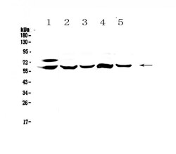 Invitrogen CES1 Polyclonal Antibody 100 &mu;g | Buy Online | Invitrogen&trade; | Fisher Scientific