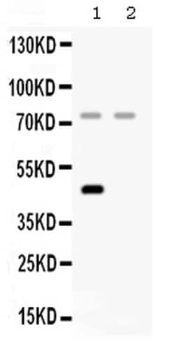 Invitrogen Complement Factor I Polyclonal Antibody 100 &mu;g; Unconjugated:Antibodies,