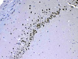 Invitrogen CHD2 Polyclonal Antibody 100 &mu;g; Unconjugated:Antibodies,