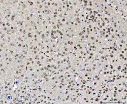 Invitrogen CHD2 Polyclonal Antibody 100 &mu;g; Unconjugated:Antibodies,