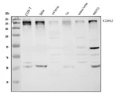 Invitrogen CHD2 Polyclonal Antibody 100 &mu;g; Unconjugated:Antibodies,