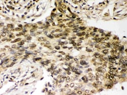 Invitrogen CHK2 Polyclonal Antibody 100 &mu;g; Unconjugated:Antibodies,