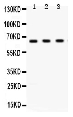 Invitrogen CHK2 Polyclonal Antibody 100 &mu;g; Unconjugated:Antibodies,