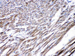 Invitrogen CHRNA5 Polyclonal Antibody 100 &mu;g; Unconjugated:Antibodies,