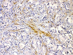 Invitrogen CHRNA5 Polyclonal Antibody 100 &mu;g; Unconjugated:Antibodies,