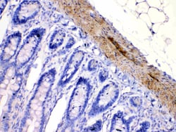 Invitrogen CHRNA5 Polyclonal Antibody 100 &mu;g; Unconjugated:Antibodies,