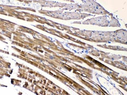 Invitrogen CHRNA5 Polyclonal Antibody 100 &mu;g; Unconjugated:Antibodies,