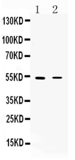 Invitrogen CHRNA5 Polyclonal Antibody 100 &mu;g; Unconjugated:Antibodies,