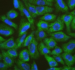 Invitrogen CIS Polyclonal Antibody 100 &mu;g; Unconjugated:Antibodies,