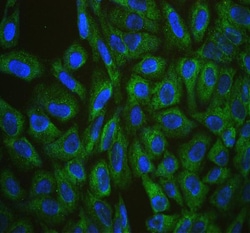 Invitrogen CIS Polyclonal Antibody 100 &mu;g; Unconjugated:Antibodies,
