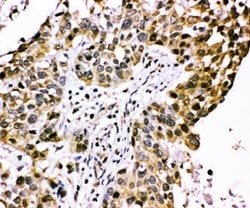 Invitrogen CIS Polyclonal Antibody 100 &mu;g; Unconjugated:Antibodies,