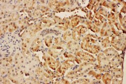Invitrogen CIS Polyclonal Antibody 100 &mu;g; Unconjugated:Antibodies,