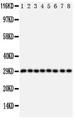 Invitrogen CIS Polyclonal Antibody 100 &mu;g; Unconjugated:Antibodies,