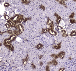 Invitrogen Creatine Kinase BB Polyclonal Antibody 100 &mu;g; Unconjugated:Antibodies,