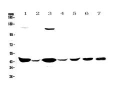Invitrogen Creatine Kinase BB Polyclonal Antibody 100 &mu;g; Unconjugated:Antibodies,