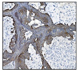 Invitrogen CLPP Polyclonal Antibody 100 &mu;g | Buy Online | Invitrogen&trade; | Fisher Scientific