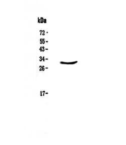 Invitrogen CLPP Polyclonal Antibody 100 &mu;g | Buy Online | Invitrogen&trade; | Fisher Scientific