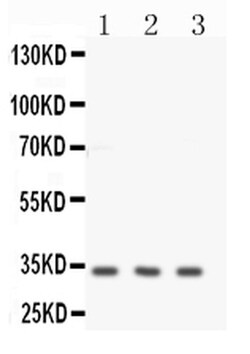 Invitrogen Calponin 1 Polyclonal Antibody 100 &mu;g; Unconjugated:Antibodies,